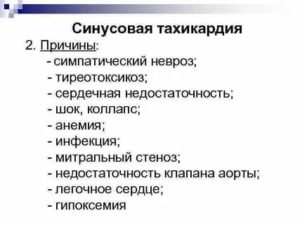 Тахикардия при неврозе